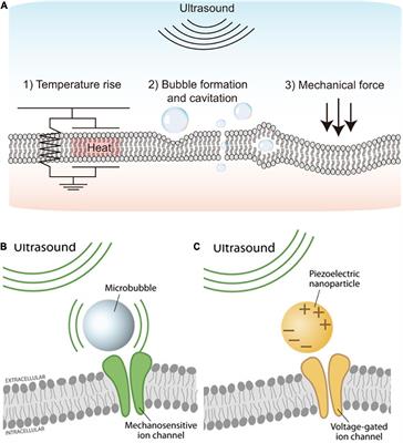 Ultrasound stimulation for non-invasive visual prostheses